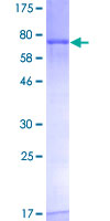 12.5% SDS-PAGE Stained with Coomassie Blue.